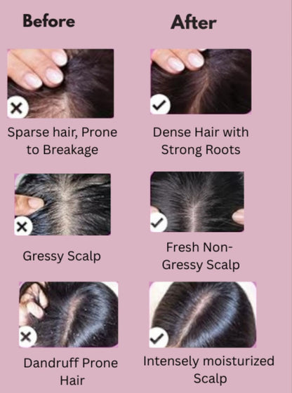 Kroindia 3-in-1 Hair Oil Applicator Scalp Massager